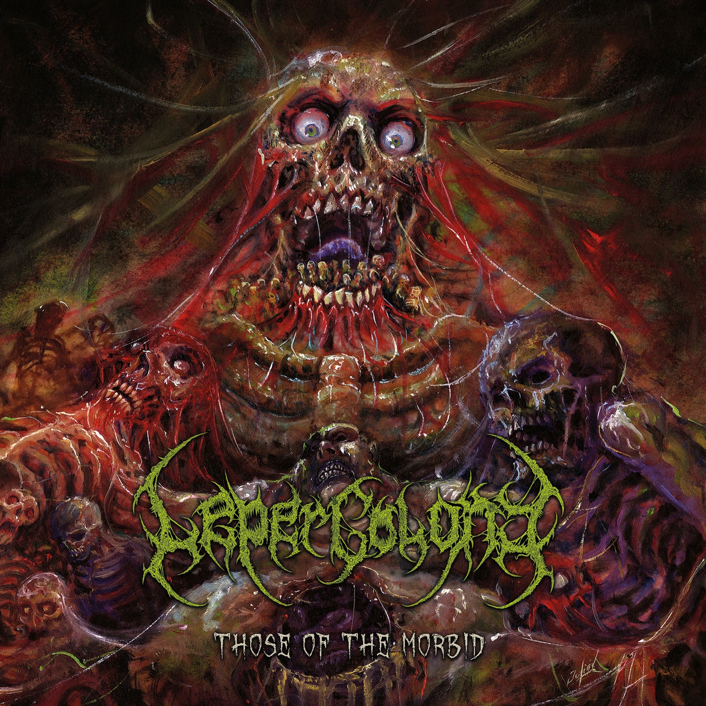 Leper Colony - Those Of The Morbid (Vinyl LP)